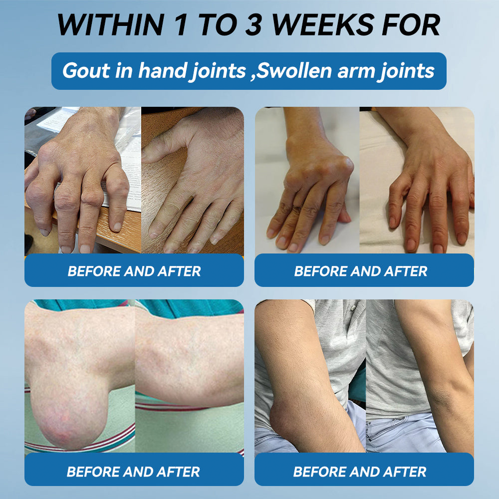 HONXI® BPC-157 Joint Healing Cream🦴Treats Arthritis, Neuropathy, Rheumatism, Sports Injuries & More 🌹