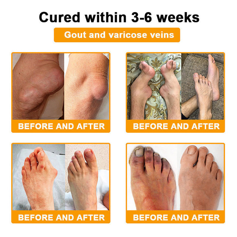 RAINDEW®🔥 BEE VENOM LITHOSPERMUM Pain-Relief Bone Healing Cream 👑👑(Specially for older adults)