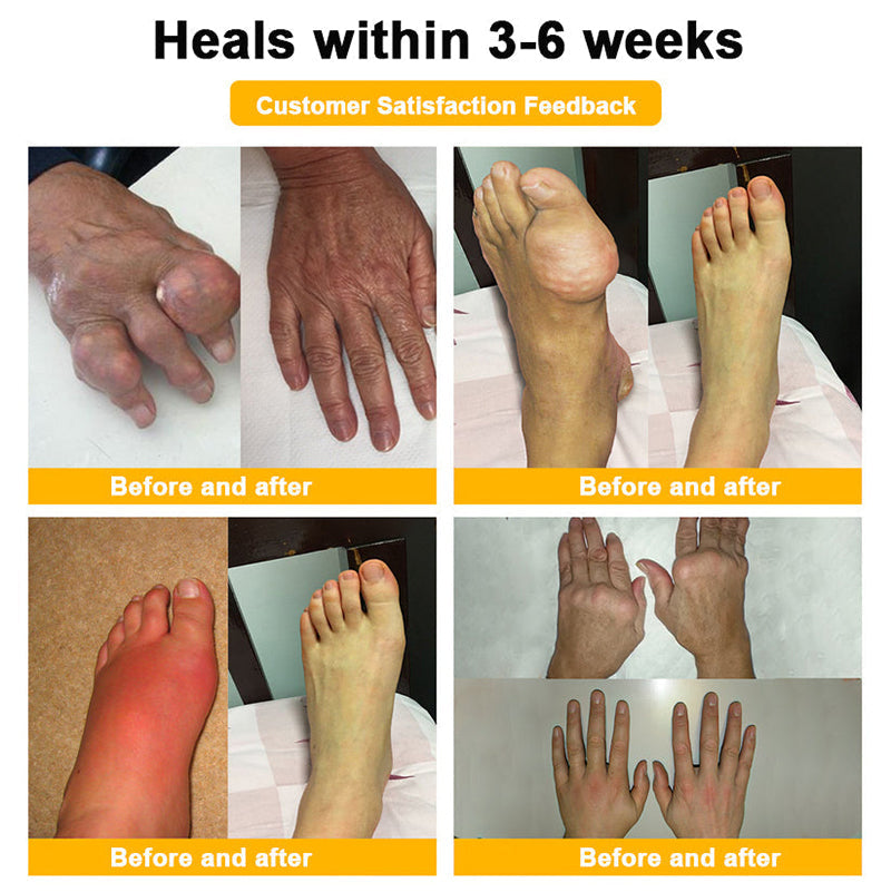 RAINDEW®🔥 BEE VENOM LITHOSPERMUM Pain-Relief Bone Healing Cream 👑👑(Specially for older adults)