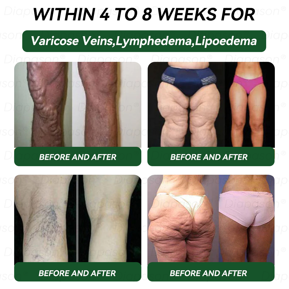 Official Store | Myo Clinic GLP-1 9-IN-1 Slim & Healthy Oral Solution(Once a day, visible results in 7 days) Supports obesity, cardiovascular health, diabetes, sleep apnea, gut health, joint issues, while also firming the skin and boosting energy