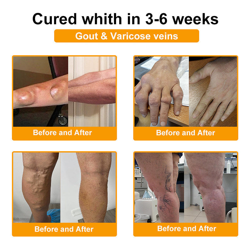 RAINDEW®🔥 BEE VENOM LITHOSPERMUM Pain-Relief Bone Healing Cream 👑👑(Specially for older adults)